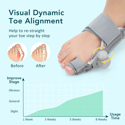 VitrinGo Bunion Corrector