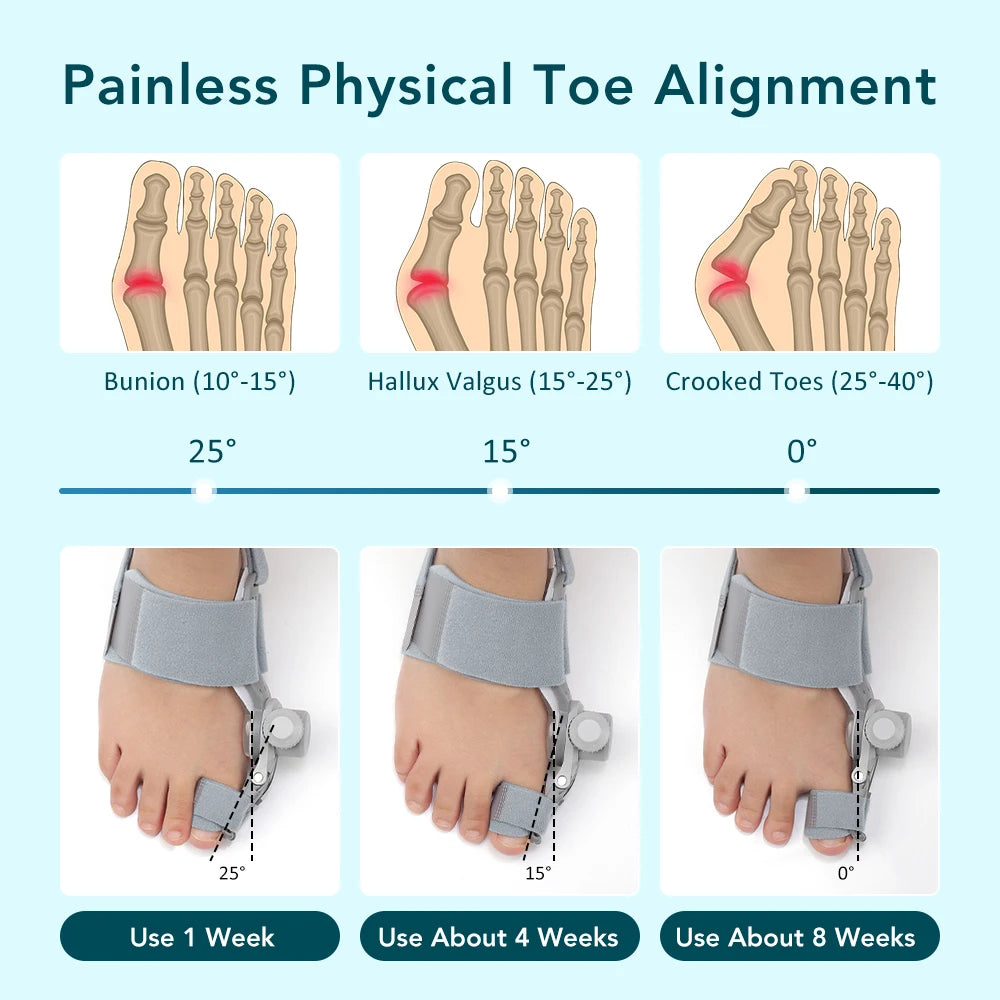 VitrinGo Bunion Corrector