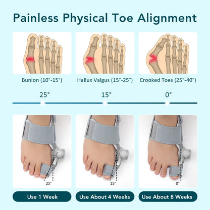 VitrinGo Bunion Corrector